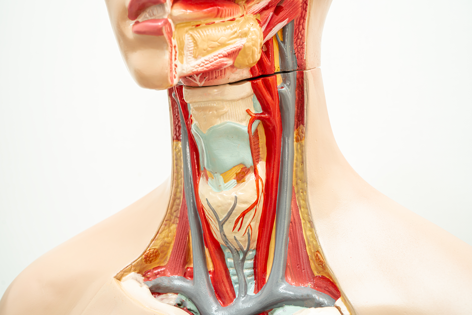 neuroproloterapia tiroidite de quervain
